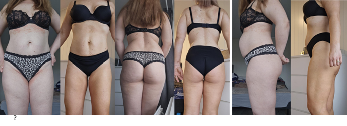 Transformare înainte / după